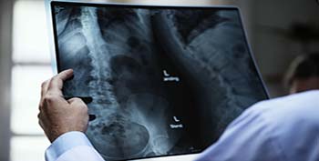 Sliding X-Ray Scan Solutions</